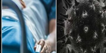 Second case of black fungus reported in Jammu: Officials