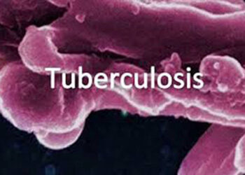 3 Kashmir districts in ‘gold’ list of highest TB reduction