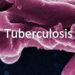 3 Kashmir districts in ‘gold’ list of highest TB reduction